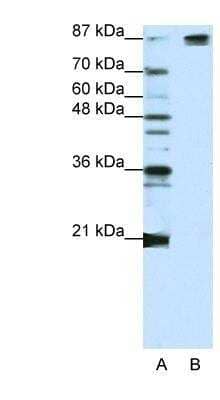 Western Blot: SAP155 Antibody [NBP1-57192] - Jurkat cell lysate, Antibody Titration: 1.25ug/ml