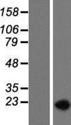 Western Blot: SAP155 Overexpression Lysate (Adult Normal) [NBP2-10754] Left-Empty vector transfected control cell lysate (HEK293 cell lysate); Right -Over-expression Lysate for SAP155.