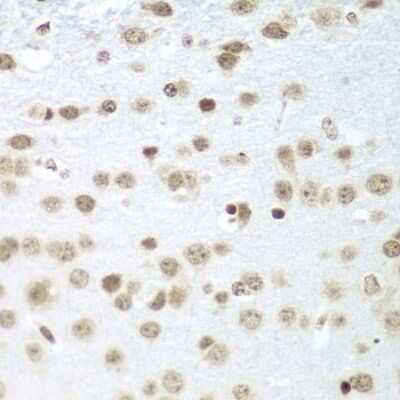 Immunohistochemistry-Paraffin SAP18 Antibody - BSA Free