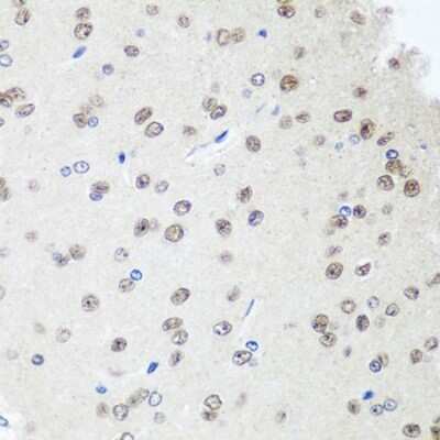 Immunohistochemistry-Paraffin SAP18 Antibody - BSA Free