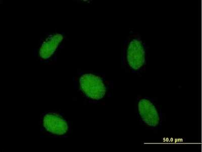 Immunocytochemistry/Immunofluorescence: SAP30 Antibody [H00008819-B01P] - Analysis of purified antibody to SAP30 on HeLa cell. (antibody concentration 10 ug/ml)