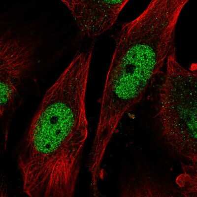 Immunocytochemistry/Immunofluorescence: SAP30 Antibody [NBP2-56769] - Staining of human cell line U-251 MG shows localization to nucleoplasm. Antibody staining is shown in green. 