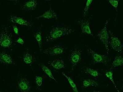 Immunocytochemistry/Immunofluorescence: SAP30 Antibody [NBP2-99031] - Immunofluorescence staining of SAP30 in Hela cells. Cells were fixed with 4% PFA, permeabilzed with 0.1% Triton X-100 in PBS, blocked with 10% serum, and incubated with rabbit anti-Human SAP30 polyclonal antibody (dilution ratio 1:500) at 4C overnight. Then cells were stained with the Alexa Fluor(R)488-conjugated Goat Anti-rabbit IgG secondary antibody (green). Positive staining was localized to Nucleus .