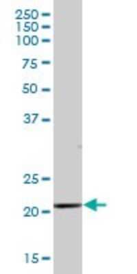 Western Blot: SAP30 Antibody [H00008819-B01P] - Analysis of SAP30 expression in human placenta.