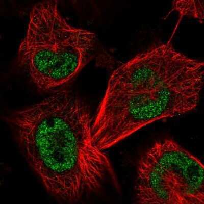 Immunocytochemistry/ Immunofluorescence SAP30BP Antibody