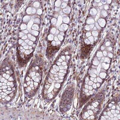 Immunohistochemistry-Paraffin: SAPCD2 Antibody [NBP1-91740] - Staining of human rectum shows moderate cytoplasmic and nuclear positivity in glandular cells.