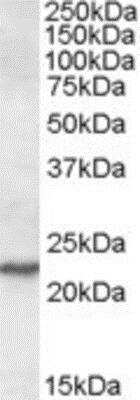 Western Blot: SAR1 Antibody [NBP1-02306] - (0.1ug/ml) staining of NIH3T3 lysate (35ug protein in RIPA buffer). Primary incubation was 1 hour. Detected by chemiluminescence.