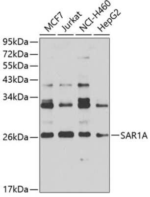 Western Blot: SAR1 Antibody [NBP2-93382] - Analysis of extracts of various cell lines, using SAR1 at 1:1000 dilution. Secondary antibody: HRP Goat Anti-Rabbit IgG (H+L) at 1:10000 dilution. Lysates/proteins: 25ug per lane. Blocking buffer: 3% nonfat dry milk in TBST. Detection: ECL Basic Kit . Exposure time: 30s.