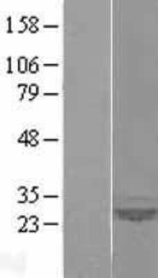 Western Blot: SAR1 Overexpression Lysate (Adult Normal) [NBL1-15691] Left-Empty vector transfected control cell lysate (HEK293 cell lysate); Right -Over-expression Lysate for SAR1.