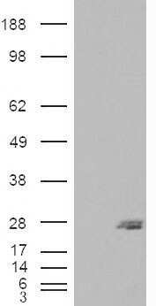 Western Blot: SAR1B Antibody [NBP1-06074] - HEK293 overexpressing SAR1B and probed with (mock transfection in first lane).