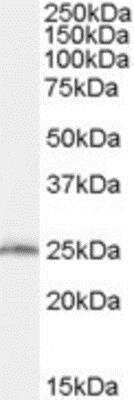 Western Blot: SAR1B Antibody [NBP1-06074] - (0.03ug/ml) staining of Mouse Liver lysate (35ug protein in RIPA buffer). Primary incubation was 1 hour. Detected by chemiluminescence.