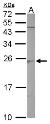 Western Blot: SAR1B Antibody [NBP1-32725] - Sample (50 ug of whole cell lysate) A: mouse brain 12% SDS PAGE, antibody diluted at 1:3000.