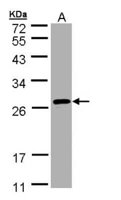 Western Blot: SAR1B Antibody [NBP1-32725] - Sample (30 ug of whole cell lysate) A: HeLa 12% SDS PAGE, antibody diluted at 1:1000.