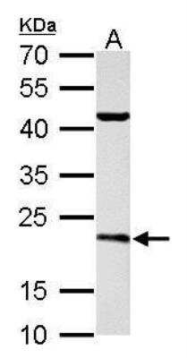 Western Blot: SAR1B Antibody [NBP1-32725] - A. 50 ug rat brain lysate/extract  12 % SDS-PAGE SAR1B antibody dilution: 1:3000