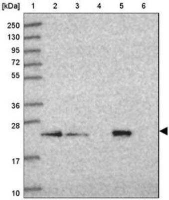 Western Blot: SAR1B Antibody [NBP2-33521] - Lane 1: Marker [kDa] 250, 130, 95, 72, 55, 36, 28, 17, 10  Lane 2: Human cell line RT-4  Lane 3: Human cell line U-251MG sp  Lane 4: Human plasma (IgG/HSA depleted)  Lane 5: Human liver tissue  Lane 6: Human tonsil tissue