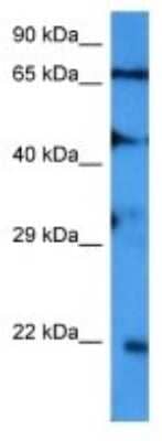 Western Blot: SAR1B Antibody [NBP3-10007] - Western blot analysis of SAR1B in Human ACHN Whole Cell. Antibody dilution at 1.0ug/ml