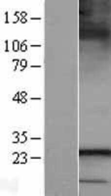 Western Blot: SAR1B Overexpression Lysate (Adult Normal) [NBL1-15692] Left-Empty vector transfected control cell lysate (HEK293 cell lysate); Right -Over-expression Lysate for SAR1B.