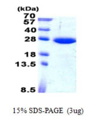 SDS-Page: Recombinant Human SAR1B Protein [NBP2-23451]