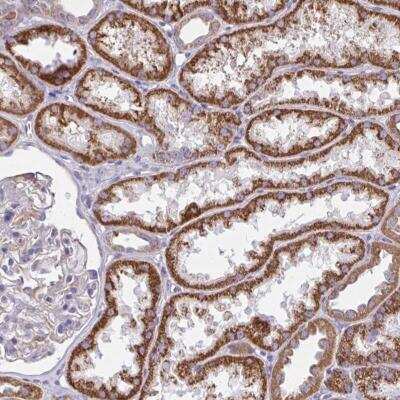 Immunohistochemistry: SARDH Antibody [NBP2-31705] - Staining of human kidney shows strong cytoplasmic positivity in cells in tubules.