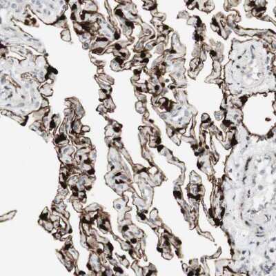 Immunohistochemistry-Paraffin: SARG Antibody [NBP1-81956] - Staining of human lung shows strong membranous positivity in pneumocytes.