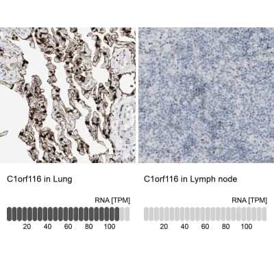Immunohistochemistry-Paraffin: SARG Antibody [NBP1-81956] - Analysis in human lung and lymph node tissues using NBP1-81956 antibody. Corresponding C1orf116 RNA-seq data are presented for the same tissues.