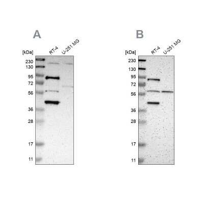 Western Blot: SARG Antibody [NBP1-81956] - Analysis using Anti-C1orf116 antibody NBP1-81956 (A) shows similar pattern to independent antibody NBP1-83487 (B).