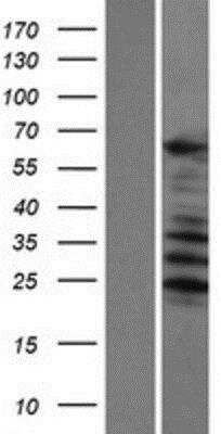 Western Blot: SARG Overexpression Lysate (Native) [NBP2-06372] - SARG Overexpression Lysate (Native) Left-Empty vector transfected control cell lysate (HEK293 cell lysate); Right -Over-expression Lysate for C1orf116.