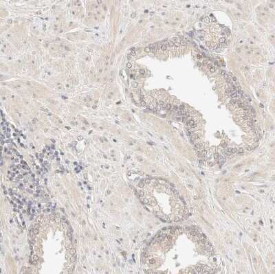 Immunohistochemistry-Paraffin: SARM1 Antibody [NBP1-87897] - Staining of human prostate shows no cytoplasmic positivity in glandular cells as expected.