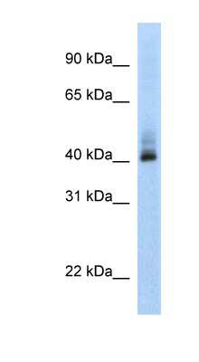 Western Blot: SARP Antibody [NBP1-70700] - MCF-7 whole cell lysates, concentration 0.2-1 ug/ml.