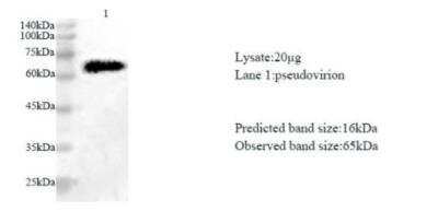 Western Blot: SARS-CoV-2 NSP10 Antibody [NBP3-07962] - Various lysates were subjected to SDS-PAGE followed by western blot with SARS-CoV-2 (2019-nCoV) NSP10 Protein antibody at dilution of 1:1000.