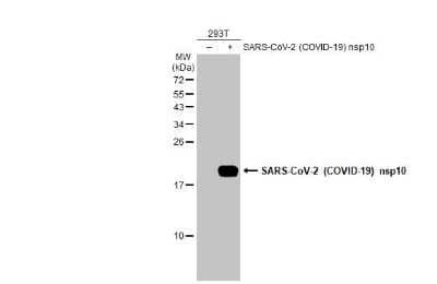 Western Blot: SARS-CoV-2 NSP10 Antibody [NBP3-13475] - Non-transfected (-) and transfected (+) 293T whole cell extracts (30 ug) were separated by 15% SDS-PAGE, and the membrane was blotted with SARS-CoV-2 (COVID-19) nsp10 antibody (NBP3-13475) diluted at 1:5000. The HRP-conjugated anti-rabbit IgG antibody