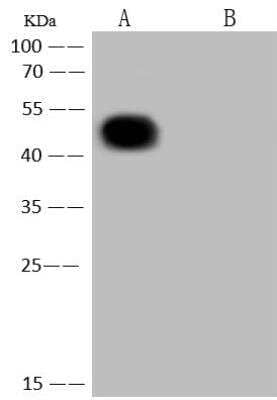 Western Blot: SARS-CoV-2 Nucleocapsid Antibody (004) [NBP3-12734] - Lane A: SARS-COV-2 Nucleocapsid overexpressed HEK293 Whole Cell LysateLane B: HEK293 Whole Cell LysateLysates/proteins at 10 ug per lane.SecondaryGoat Anti-Rabbit IgG (H+L)/HRP at 1/10000 dilutionDeveloped using the ECL technique.Performed under reducing condition