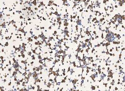 Immunohistochemistry-Paraffin: SARS-CoV-2 Nucleocapsid Antibody (019) [NBP3-12735] - Analysis of Nucleocapsid overexpresssed Hek293 Cells were stained with purified anti-SARS-CoV-2 Nucleocapsid Rabbit Mab,then a HRP-conjugated second step antibody.