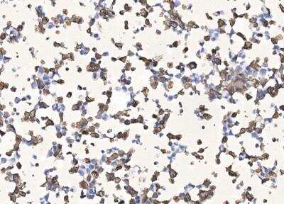 Immunocytochemistry/Immunofluorescence: SARS-CoV-2 Nucleocapsid Antibody (040) [NBP3-12736] - Analysis of Nucleocapsid overexpresssed Hek293 Cells were stained with purified anti-SARS-CoV-2 Nucleocapsid Rabbit Mab,then a HRP-conjugated second step antibody.