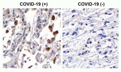 Immunohistochemistry-Paraffin SARS-CoV-2 ORF3b Antibody - BSA Free