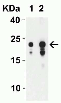 Western Blot SARS-CoV-2 ORF3b Antibody - BSA Free