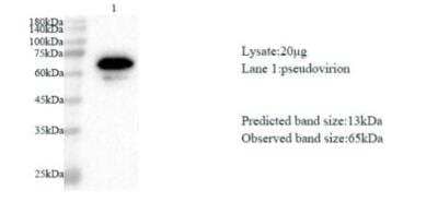 Western Blot: SARS-CoV-2 ORF8 Antibody [NBP3-07972] - Various lysates were subjected to SDS-PAGE followed by western blot with SARS-CoV-2 (2019-nCoV) ORF8 Protein antibody at dilution of 1:1000.