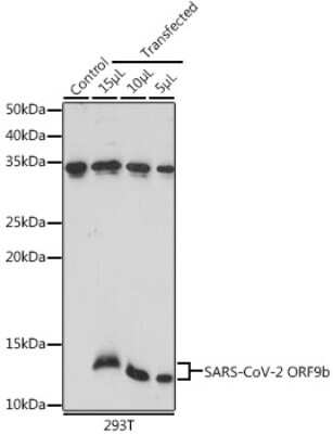 Western Blot: SARS-CoV-2 ORF9b Antibody [NBP3-15988] - Analysis of extracts of normal 293T cells 293T transfected with ORF9b Protein, using SARS-CoV-2 ORF9b antibody (NBP3-15988) at 1:1000 dilution. Secondary antibody: HRP Goat Anti-Rabbit IgG (H+L) at 1:10000 dilution. Lysates/proteins: 25ug per lane. Blocking buffer: 3% nonfat dry milk in TBST. Detection: ECL Basic Kit. Exposure time: 30s.