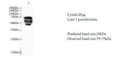 Western Blot: SARS-CoV-2 nsp1 Antibody [NBP3-07961] - Various lysates were subjected to SDS-PAGE followed by western blot with SARS-CoV-2 (2019-nCoV) NSP1 Protein antibody at dilution of 1:1000.