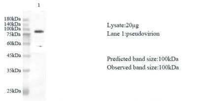 Western Blot: SARS-CoV-2 nsp12 Antibody [NBP3-07963] - Various lysates were subjected to SDS-PAGE followed by western blot with SARS-CoV-2 (2019-nCoV) NSP12 Protein antibody at dilution of 1:1000.