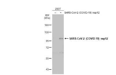 Western Blot: SARS-CoV-2 nsp12 Antibody [NBP3-13457] - Non-transfected (-) and transfected (+) 293T whole cell extracts (30 ug) were separated by 7.5% SDS-PAGE, and the membrane was blotted with SARS-CoV-2 (COVID-19) nsp12 antibody (NBP3-13457) diluted at 1:5000. The HRP-conjugated anti-rabbit IgG antibody (NBP2-19301) was used to detect the primary antibody.