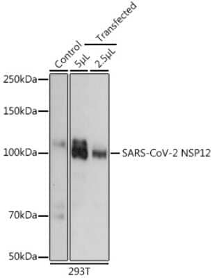 Western Blot: SARS-CoV-2 nsp12 Antibody [NBP3-15984] - Analysis of extracts of normal 293T cells 293T transfected with NSP12 Protein, using SARS-CoV-2 nsp12 antibody (NBP3-15984) at 1:5000 dilution. Secondary antibody: HRP Goat Anti-Rabbit IgG (H+L) at 1:10000 dilution. Lysates/proteins: 25ug per lane. Blocking buffer: 3% nonfat dry milk in TBST. Detection: ECL Basic Kit. Exposure time: 10s.
