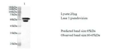 Western Blot: SARS-CoV-2 nsp13 Antibody [NBP3-07964] - Various lysates were subjected to SDS-PAGE followed by western blot with SARS-CoV-2 (2019-nCoV) Nsp13 Protein antibody at dilution of 1:1000.