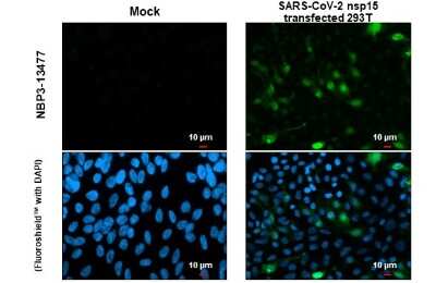 Immunocytochemistry/Immunofluorescence: SARS-CoV-2 nsp15 Antibody [NBP3-13477] - SARS-CoV-2 (COVID-19) nsp15 antibody detects SARS-CoV-2 (COVID-19) nsp15 protein at cytoplasm by immunofluorescent analysis. Sample: Mock and transfected transfected 293T cells were fixed in 4% paraformaldehyde at RT for 15 min. Green: SARS-CoV-2 (COVID-19) nsp15 stained by SARS-CoV-2 (COVID-19) nsp15 antibody (NBP3-13477) diluted at 1:2000.