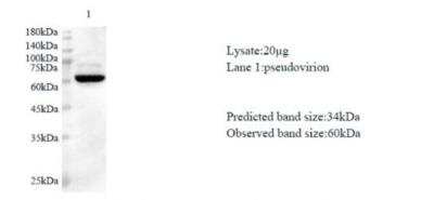 Western Blot: SARS-CoV-2 nsp16 Antibody [NBP3-07965] - Various lysates were subjected to SDS-PAGE followed by western blot with SARS-CoV-2 (2019-nCoV) NSP16 Protein antibody at dilution of 1:1000.