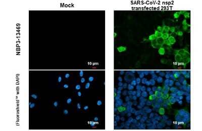 Immunocytochemistry/Immunofluorescence: SARS-CoV-2 nsp2 Antibody [NBP3-13469] - SARS-CoV-2 (COVID-19) nsp2 antibody detects SARS-CoV-2 (COVID-19) nsp2 protein at cytoplasm by immunofluorescent analysis. Sample: Mock and transfected transfected 293T cells were fixed in 4% paraformaldehyde at RT for 15 min. Green: SARS-CoV-2 (COVID-19) nsp2 stained by SARS-CoV-2 (COVID-19) nsp2 antibody (NBP3-13469) diluted at 1:2000.