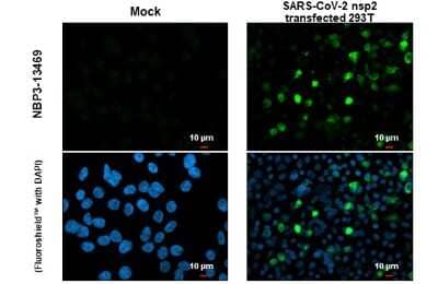 Immunocytochemistry/Immunofluorescence: SARS-CoV-2 nsp2 Antibody [NBP3-13469] - SARS-CoV-2 (COVID-19) nsp2 antibody detects SARS-CoV-2 (COVID-19) nsp2 protein at cytoplasm by immunofluorescent analysis. Sample: Mock and transfected transfected 293T cells were fixed in 4% paraformaldehyde at RT for 15 min. Green: SARS-CoV-2 (COVID-19) nsp2 stained by SARS-CoV-2 (COVID-19) nsp2 antibody (NBP3-13469) diluted at 1:2000.