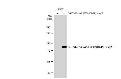 Western Blot: SARS-CoV-2 nsp2 Antibody [NBP3-13469] - Non-transfected (-) and transfected (+) 293T whole cell extracts (30 ug) were separated by 7.5% SDS-PAGE, and the membrane was blotted with SARS-CoV-2 (COVID-19) nsp2 antibody (NBP3-13469) diluted at 1:5000. The HRP-conjugated anti-rabbit IgG antibody (NBP2-19301) was used to detect the primary antibody.