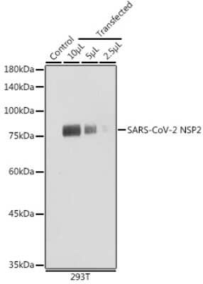 Western Blot: SARS-CoV-2 nsp2 Antibody [NBP3-15990] - Western blot analysis of extracts of normal 293T cells and 293T transfected with NSP2 Protein, using SARS-CoV-2 nsp2 antibody (NBP3-15990) at 1:5000 dilution. Secondary antibody: HRP Goat Anti-Rabbit IgG (H+L) at 1:10000 dilution. Lysates/proteins: 25ug per lane. Blocking buffer: 3% nonfat dry milk in TBST. Detection: ECL Basic Kit. Exposure time: 5s.