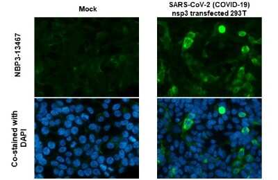Immunocytochemistry/Immunofluorescence: SARS-CoV-2 nsp3 Antibody [NBP3-13467] - SARS-CoV-2 (COVID-19) nsp3 antibody detects SARS-CoV-2 (COVID-19) nsp3 protein by immunofluorescent analysis. Sample: Mock and transfected 293T cells were fixed in 4% paraformaldehyde at RT for 15 min. Green: SARS-CoV-2 (COVID-19) nsp3 stained by SARS-CoV-2 (COVID-19) nsp3 antibody (NBP3-13467) diluted at 1:1000. Blue: Fluoroshield with DAPI.